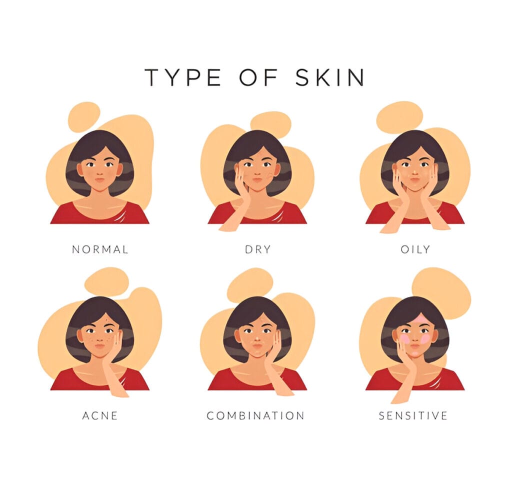 Different skin types